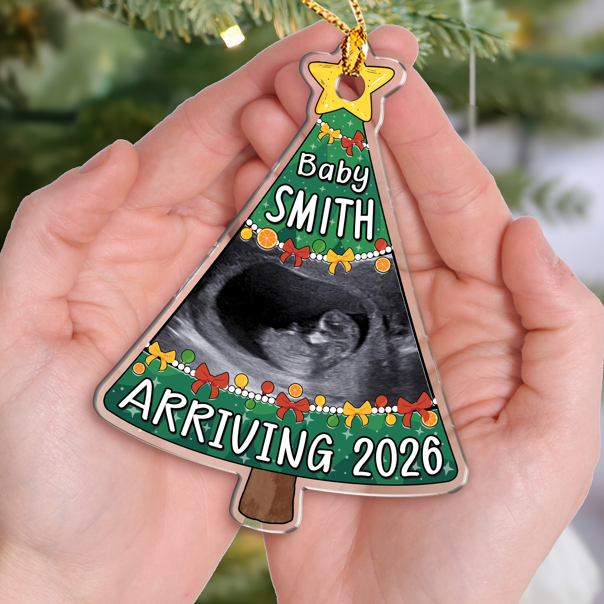 Custom Ultrasound Ornament